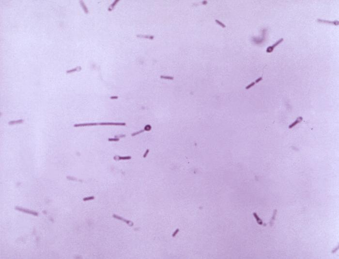 Anaerobes and Pseudomonas Opportunistic Infections